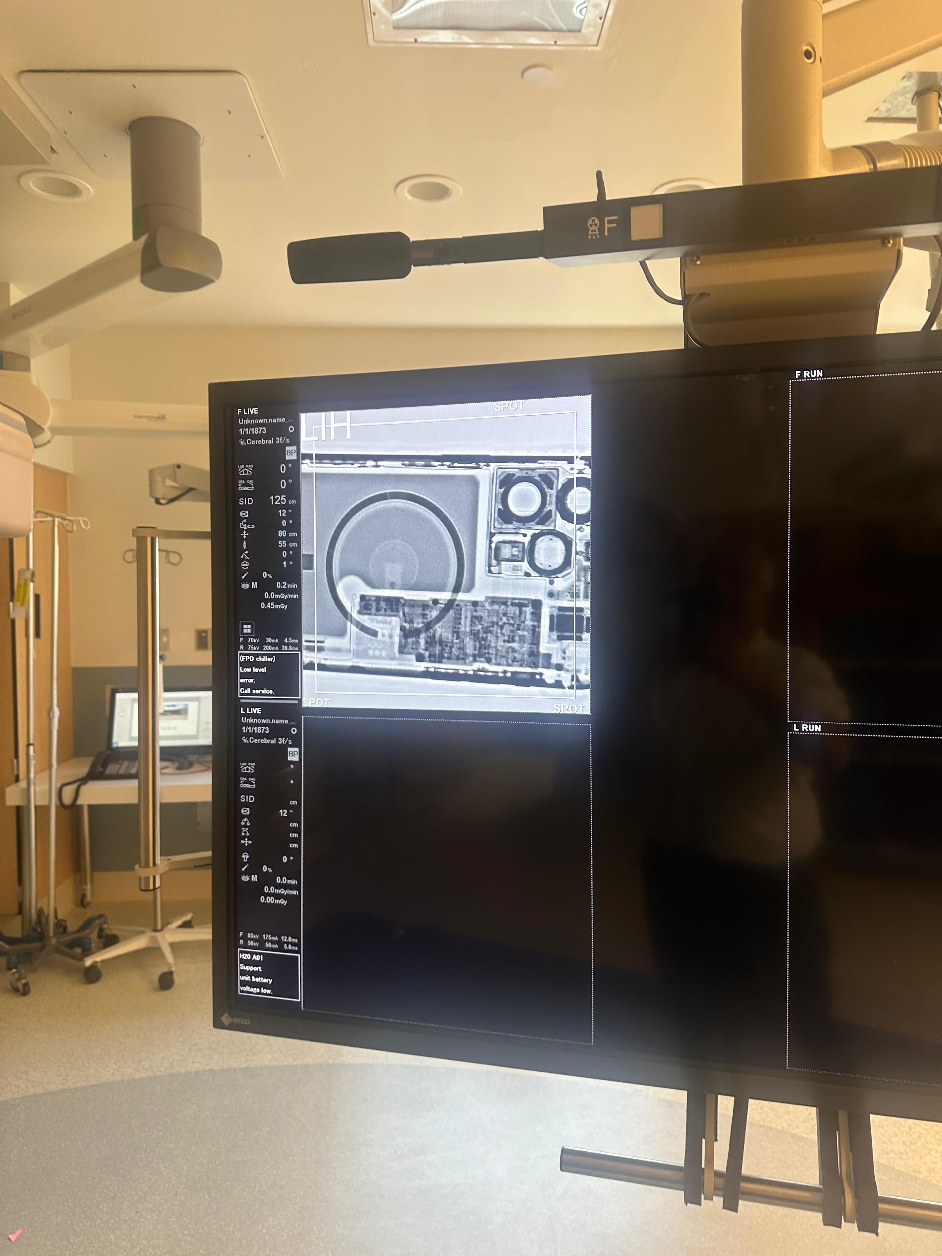 Canon Infinix I Angiography Suite